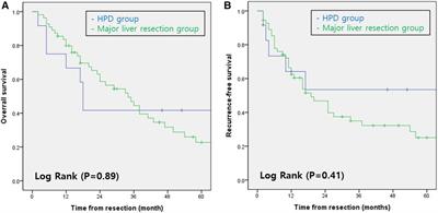 Advancing treatment for perihilar cholangiocarcinoma: role of hepatopancreaticoduodenectomy in small-volume centers